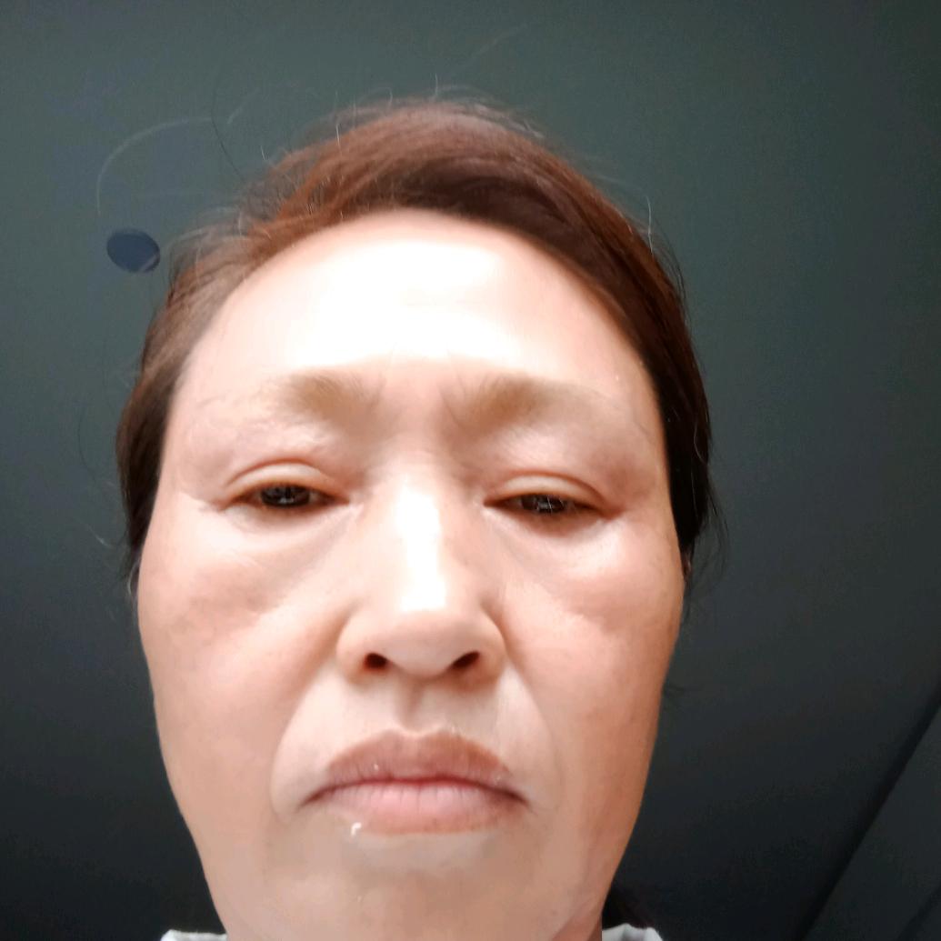 志喜