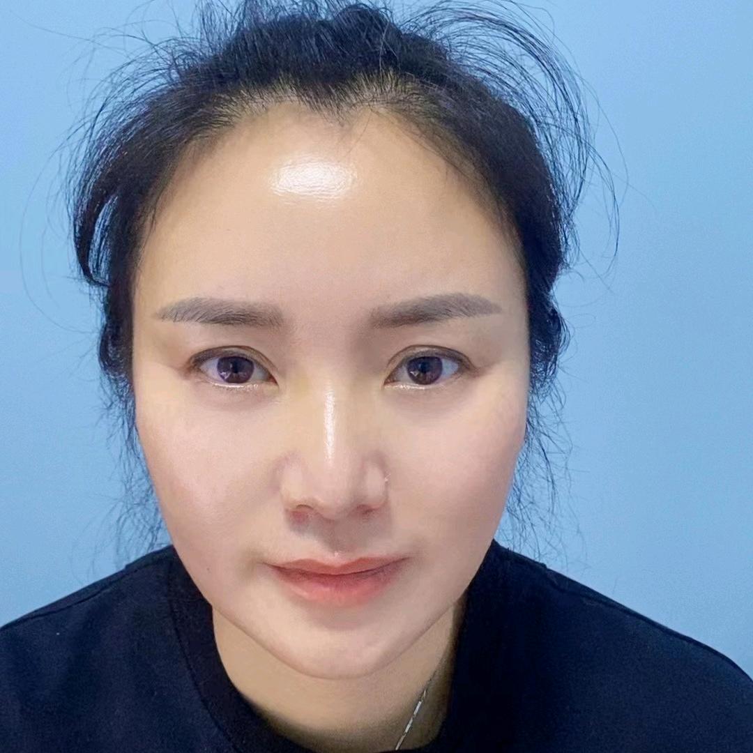 重庆素颜音子姐（专注斑敏痘）