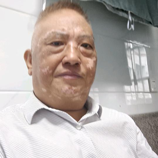 白斑幸运者