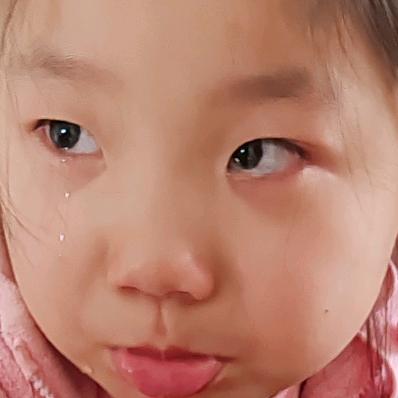 脑壳疼