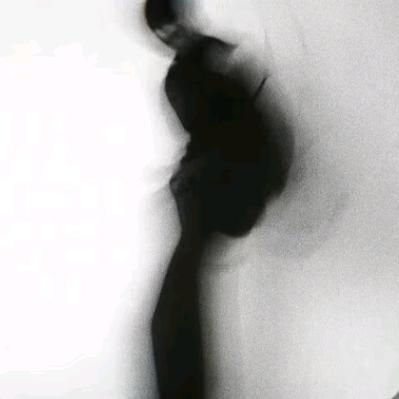 梦见我们和好