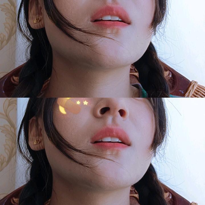 治愈€♛