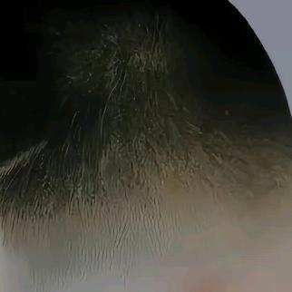 阿畅
