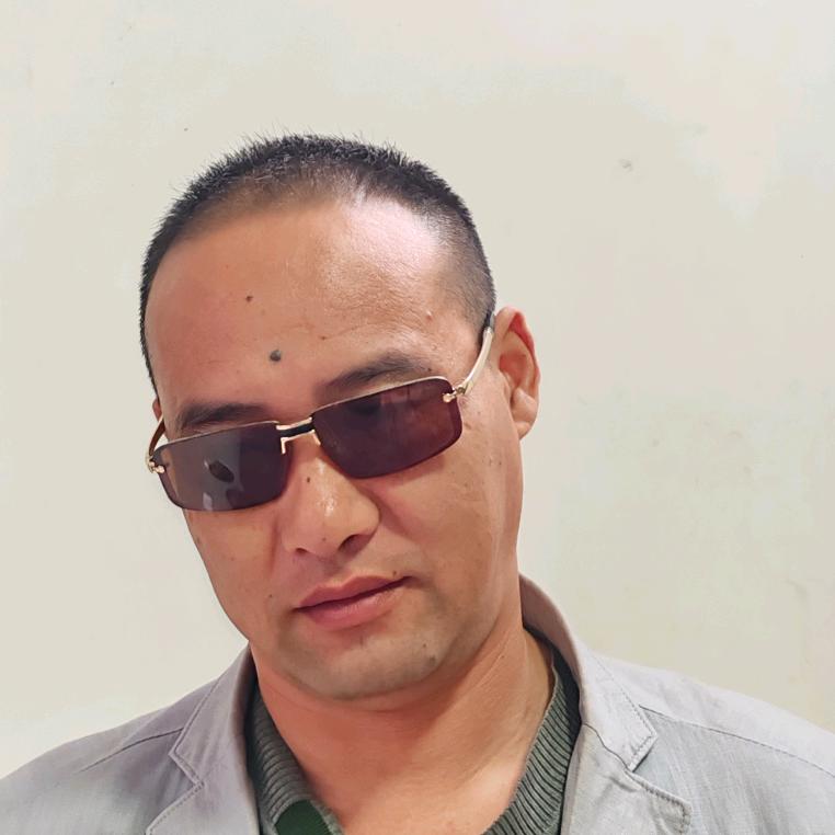 脱发雄性激素脱发，指导