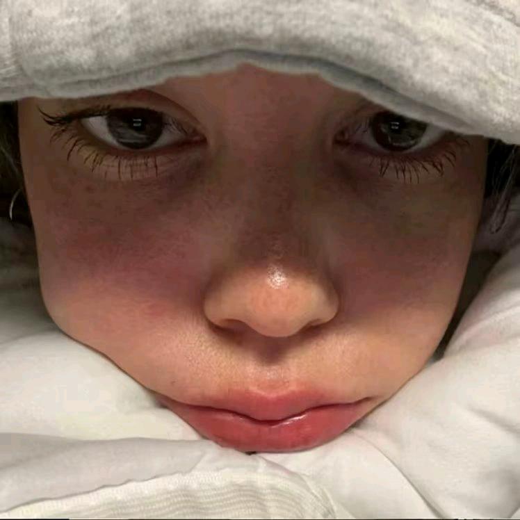 Y  .