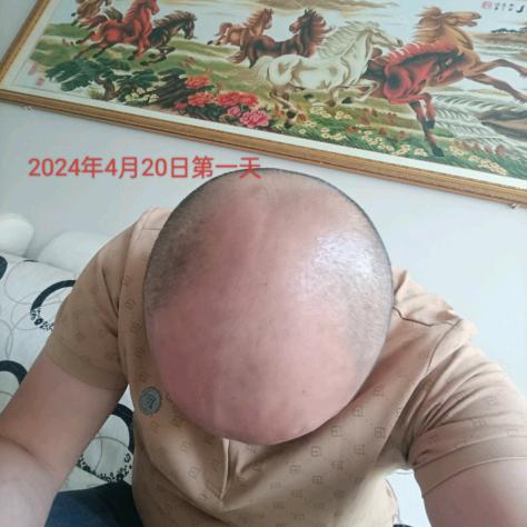 孤军(七级脱发已上岸)