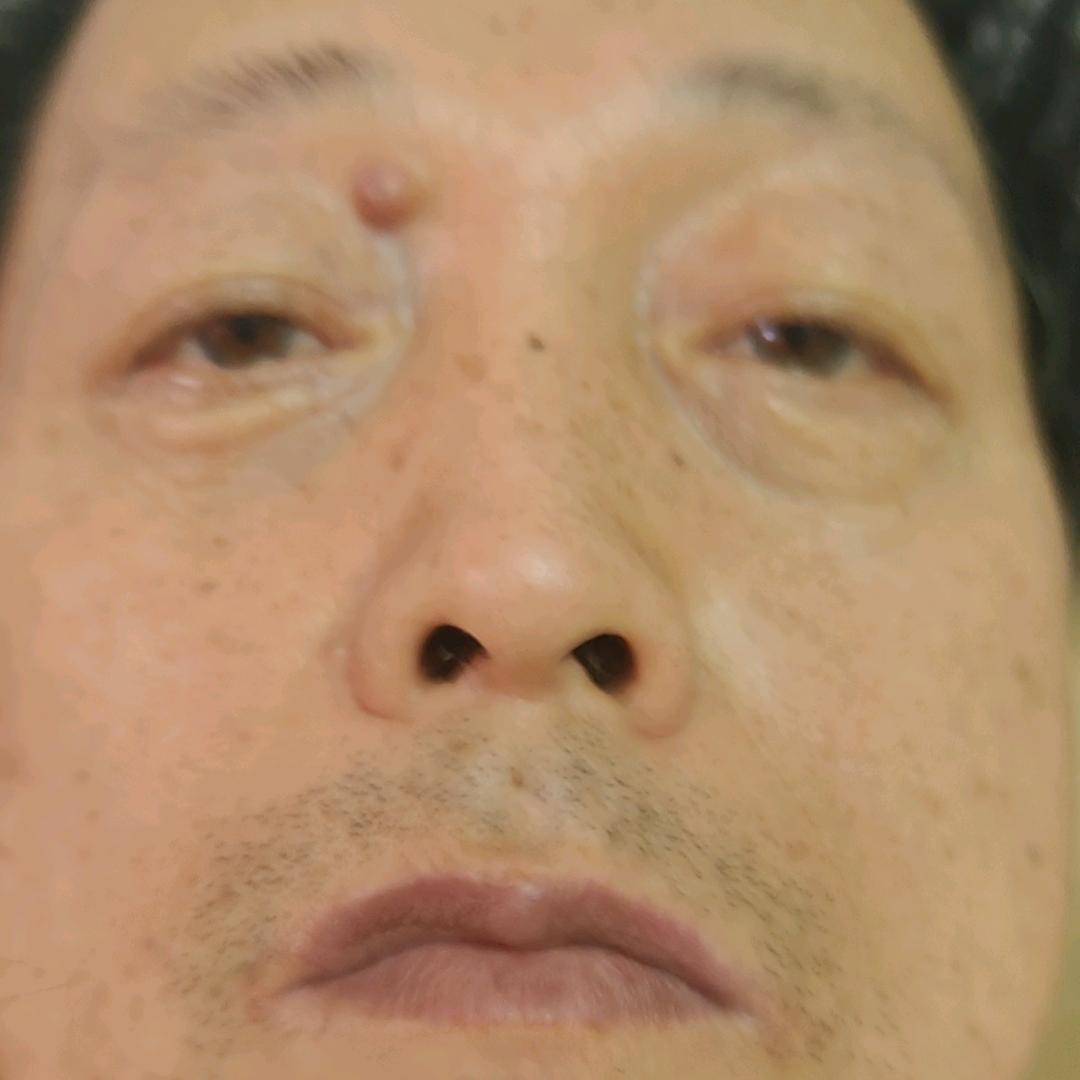张叫兽