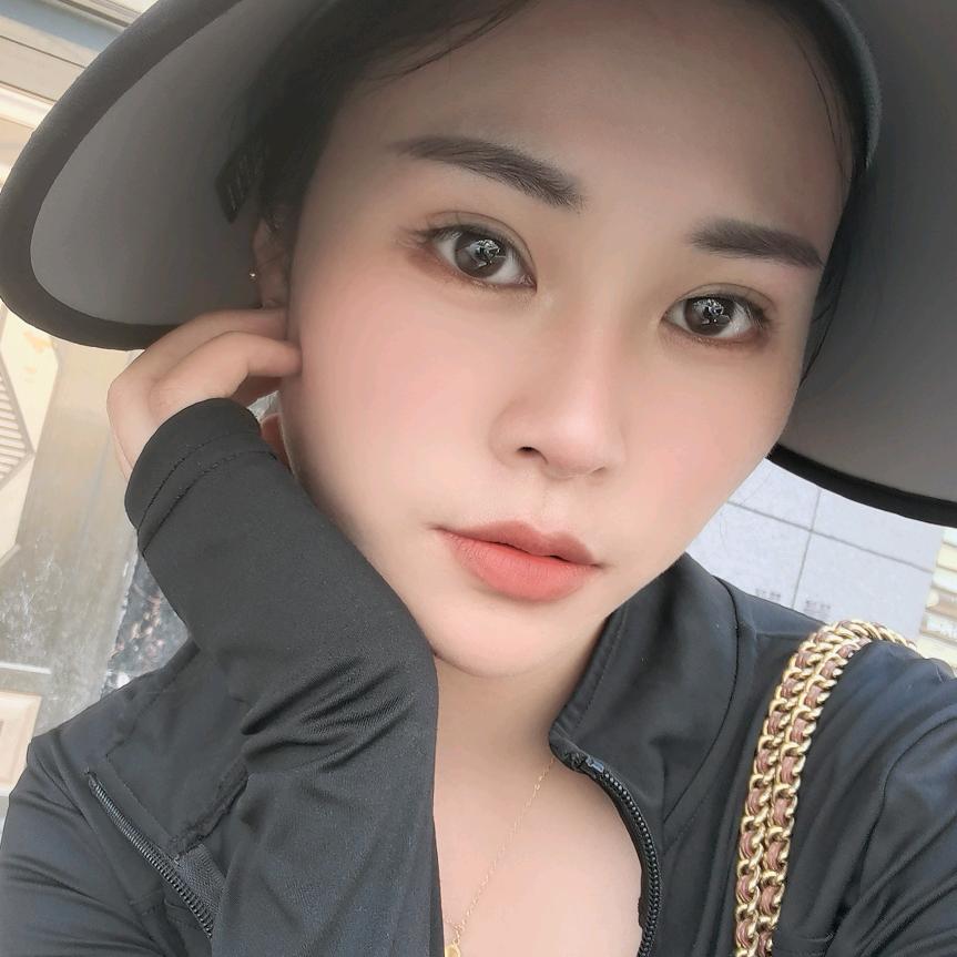 顶木绿化杆批发