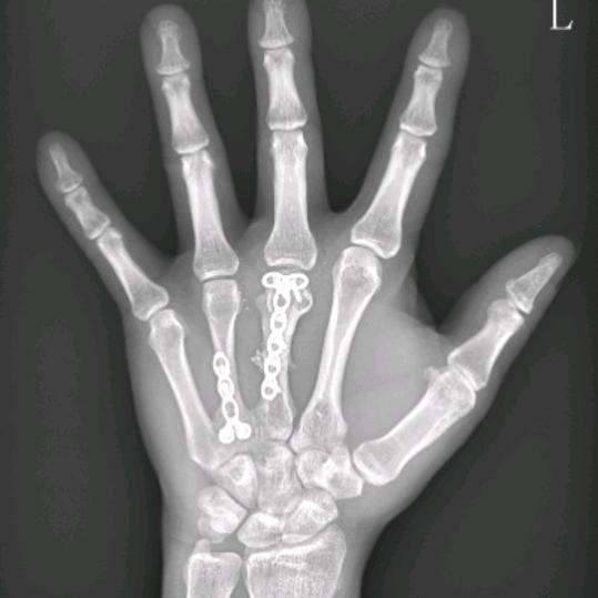 爱情鸟已飞走。