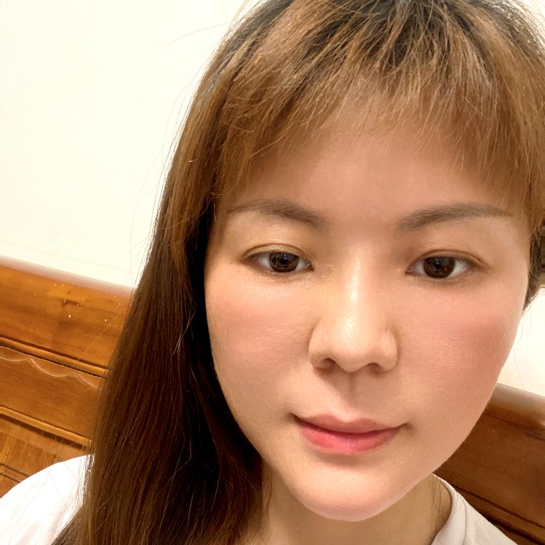 华玥～斑疤痘终点站