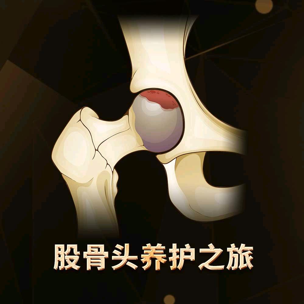 股骨头保髋企业店