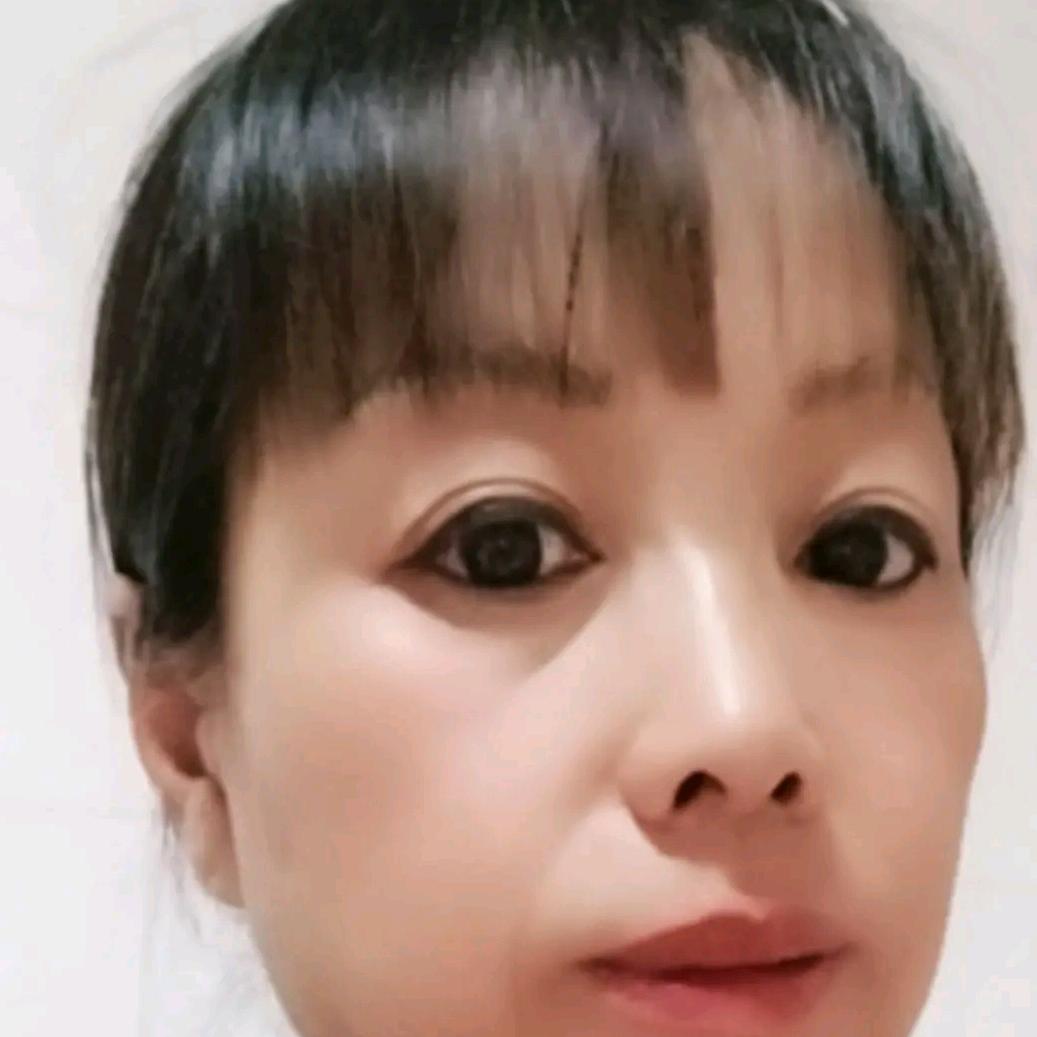 开心果