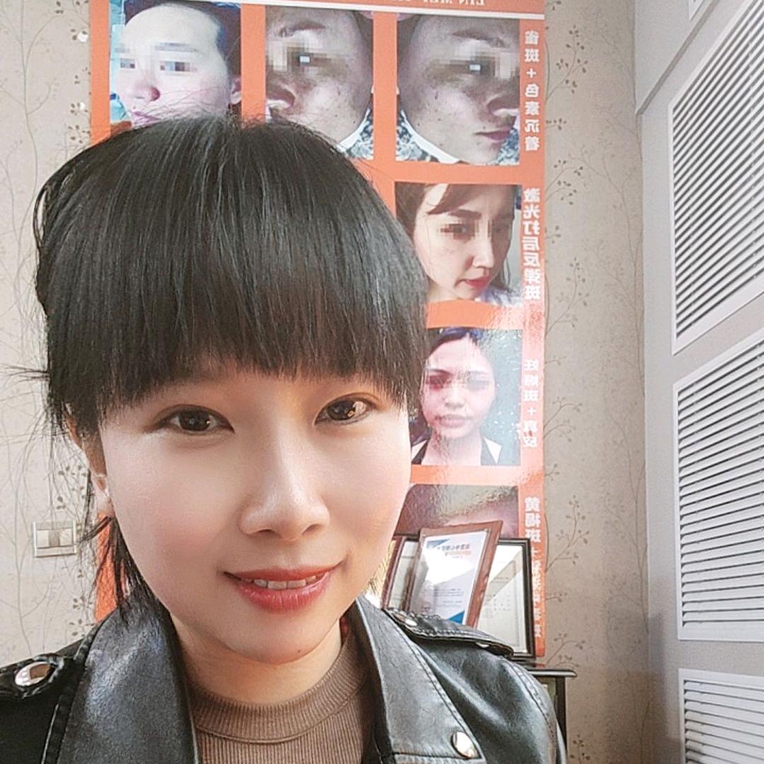 临汾芳姐有妙招（八年老店专治班班点点）