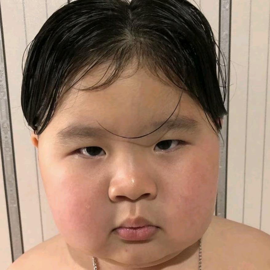 紫外线