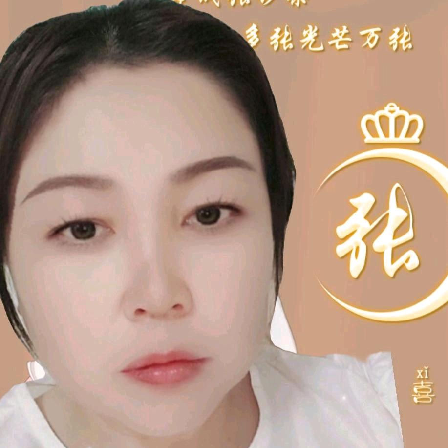 张琼