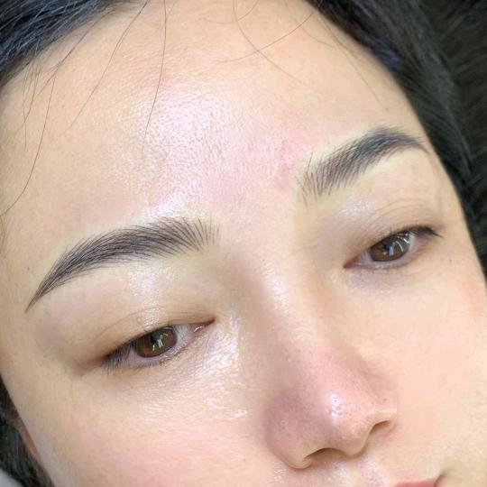 纹绣祛斑私人订制