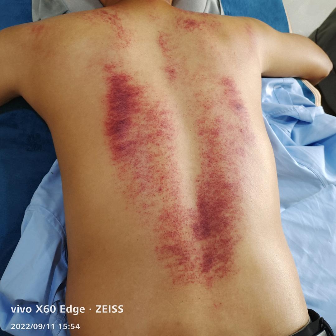 叮光恰盖光咚咚