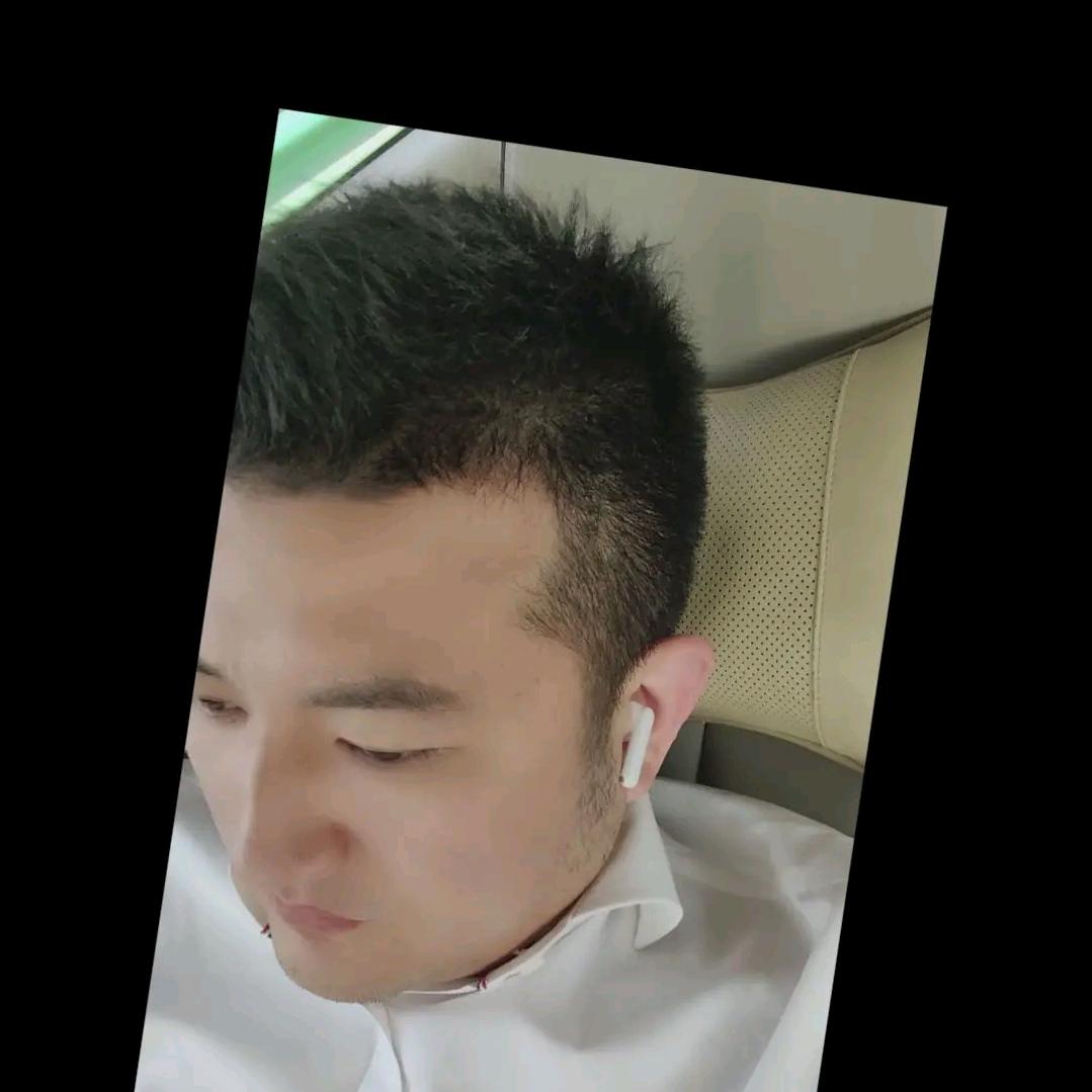 恒川激光-何小川