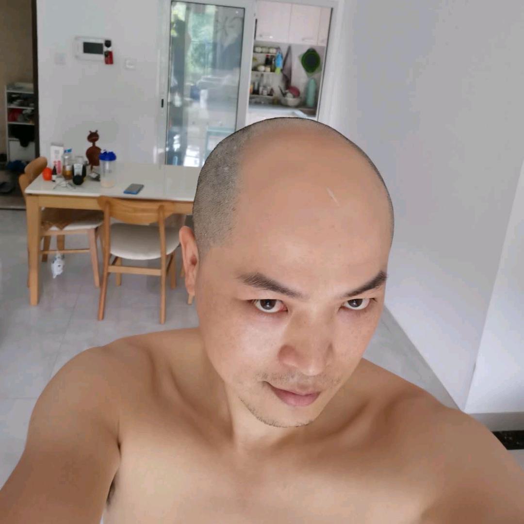 楚哥脱发自救