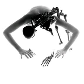 L: