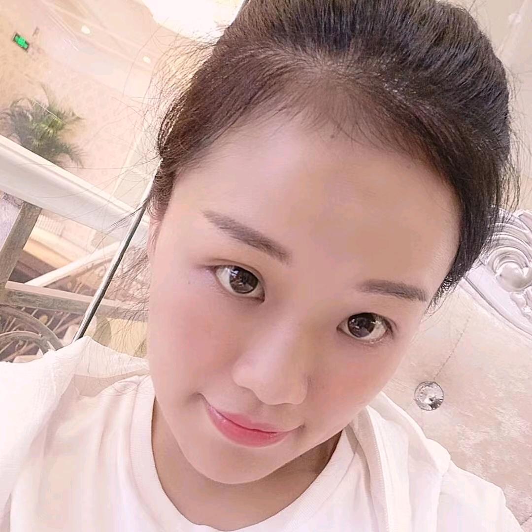 惠雯