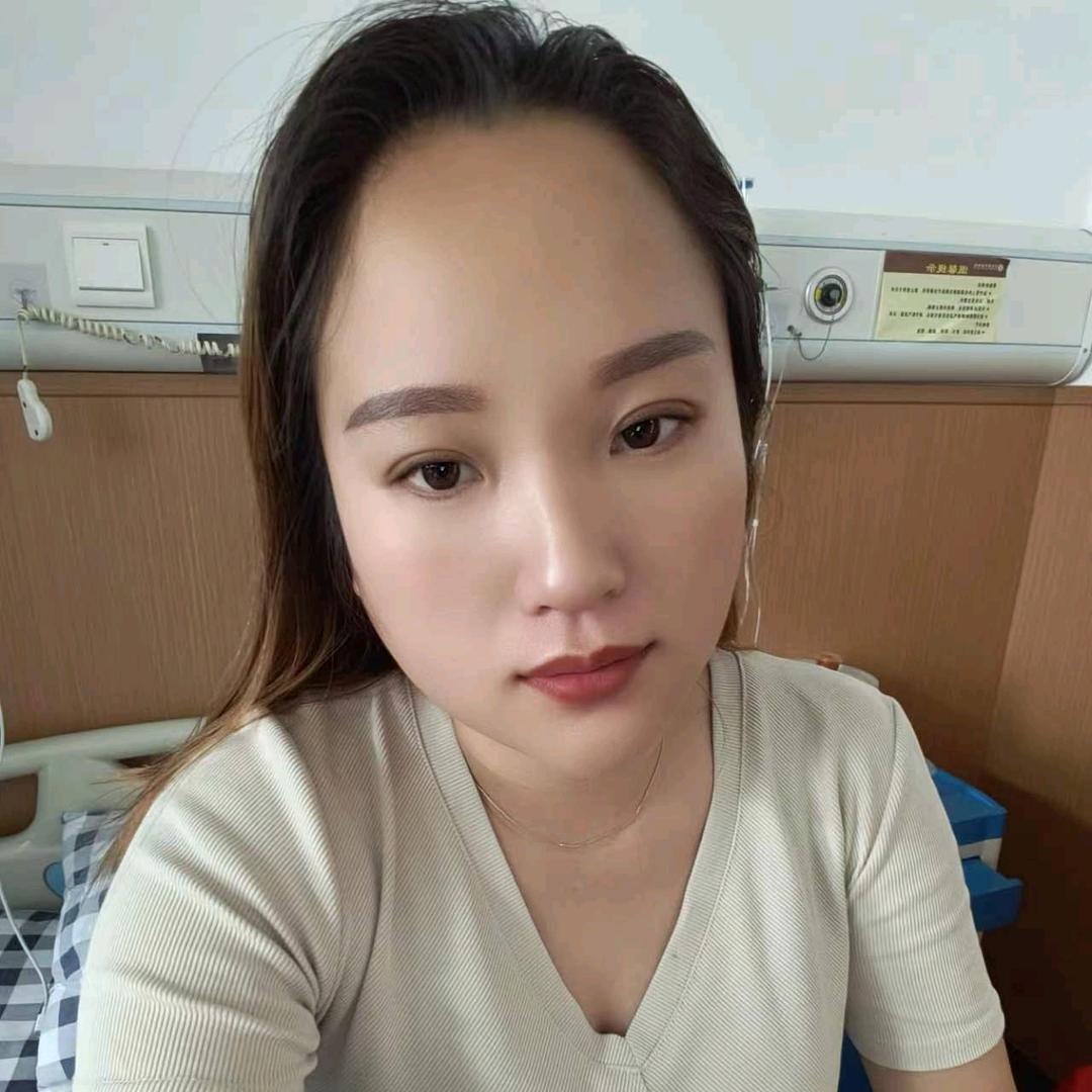 贵州二型糖尿病王阿认