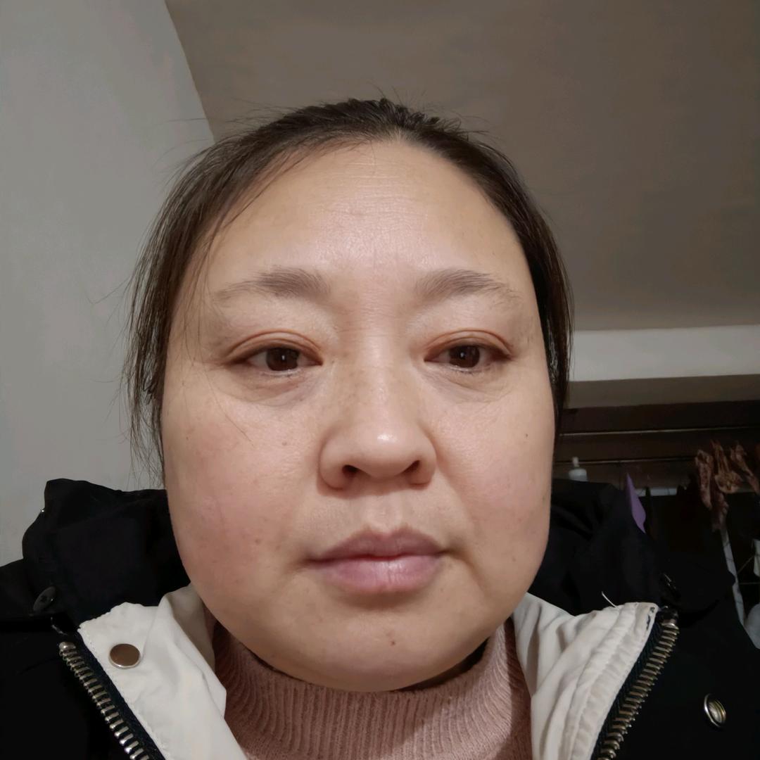 杨明琴