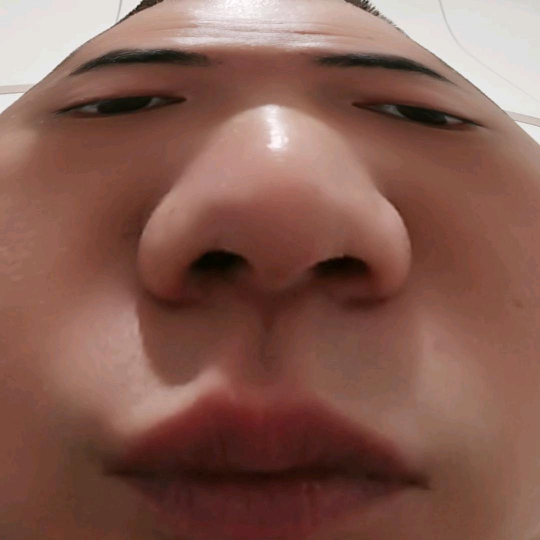 大头菜　　　　　　   🕷️