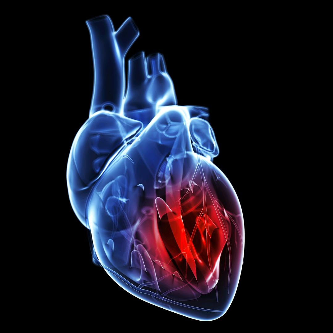 换个心脏会更好