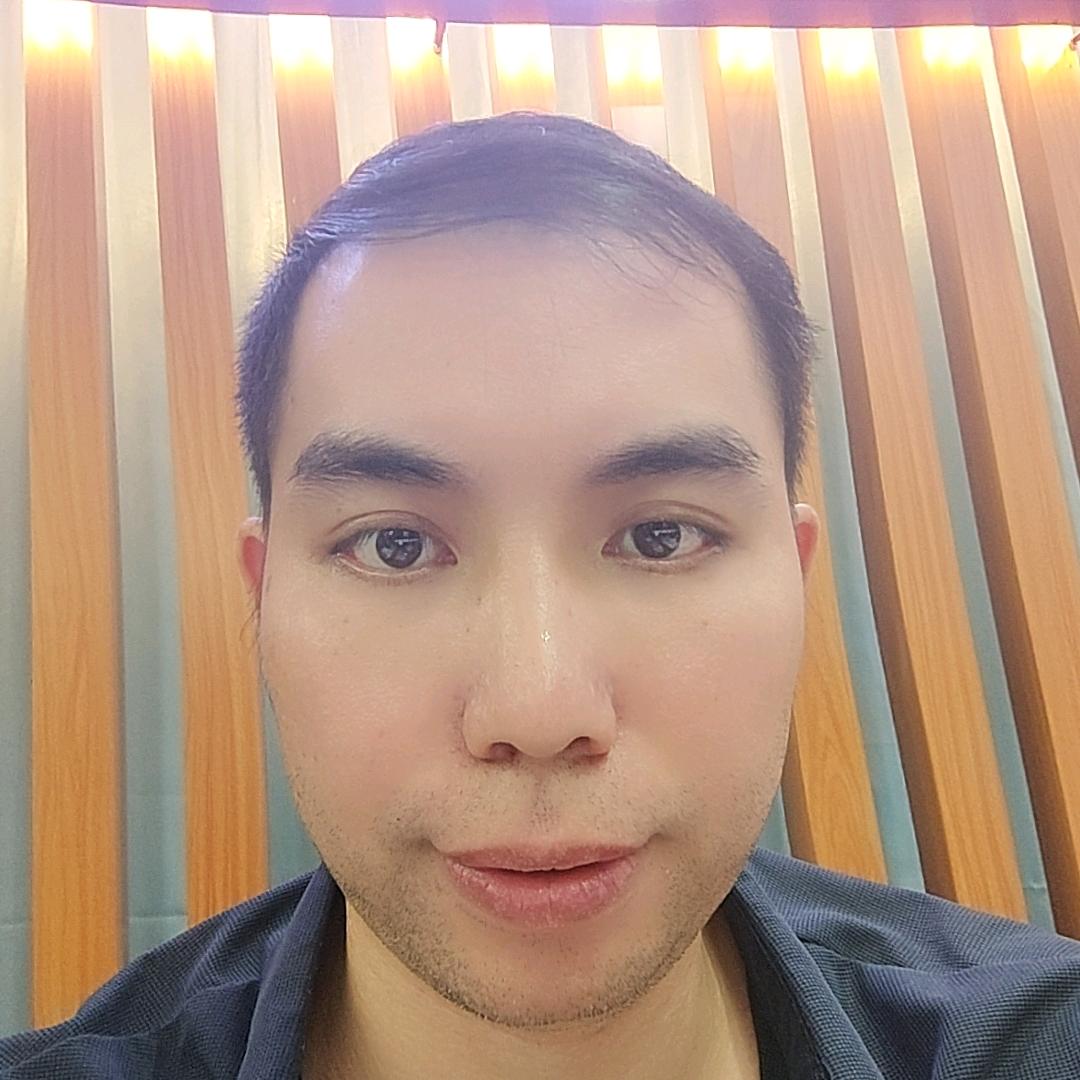 华哥不植发不戴假发