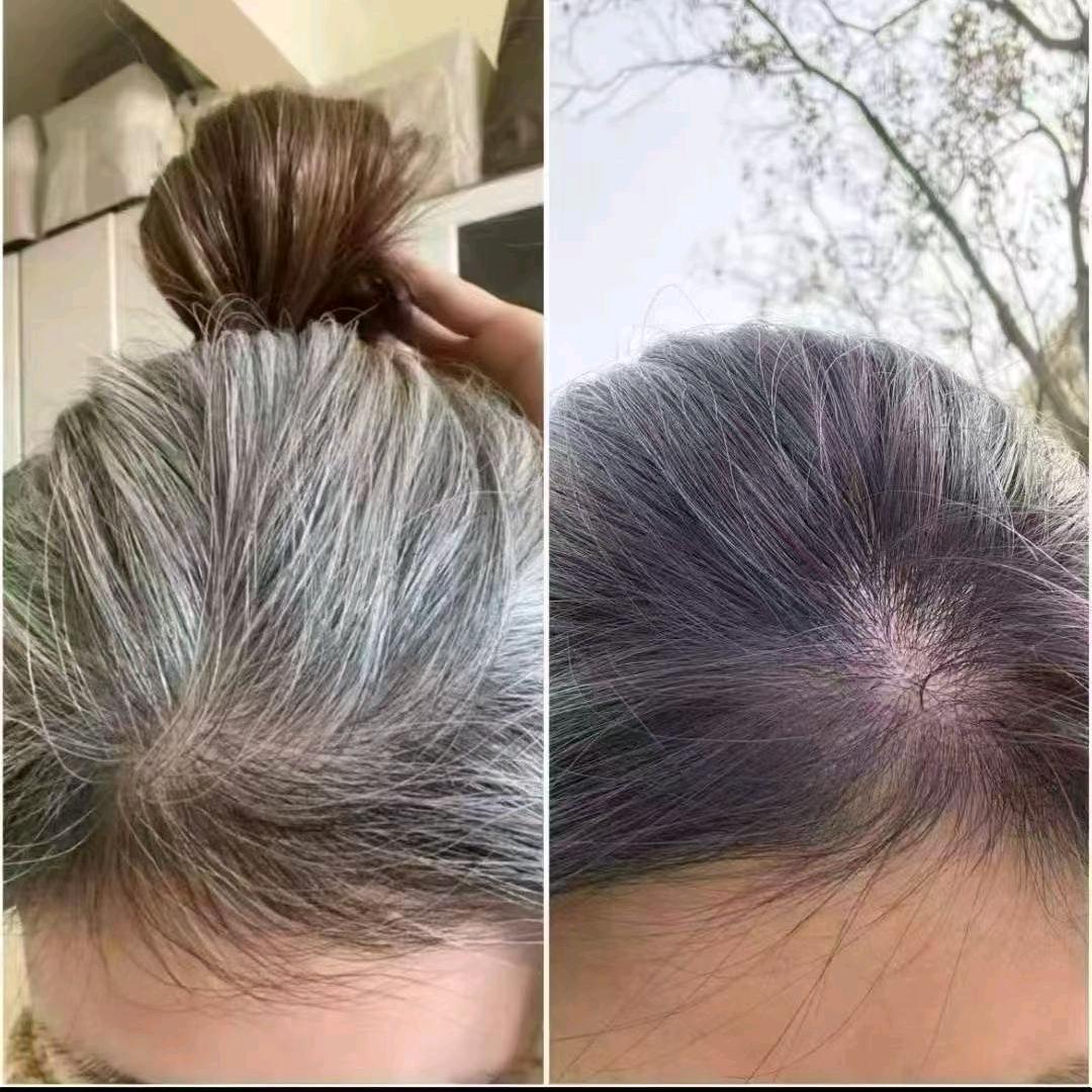 阳阳爱养发
