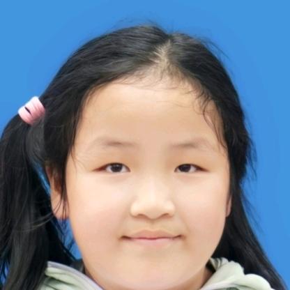 张雷