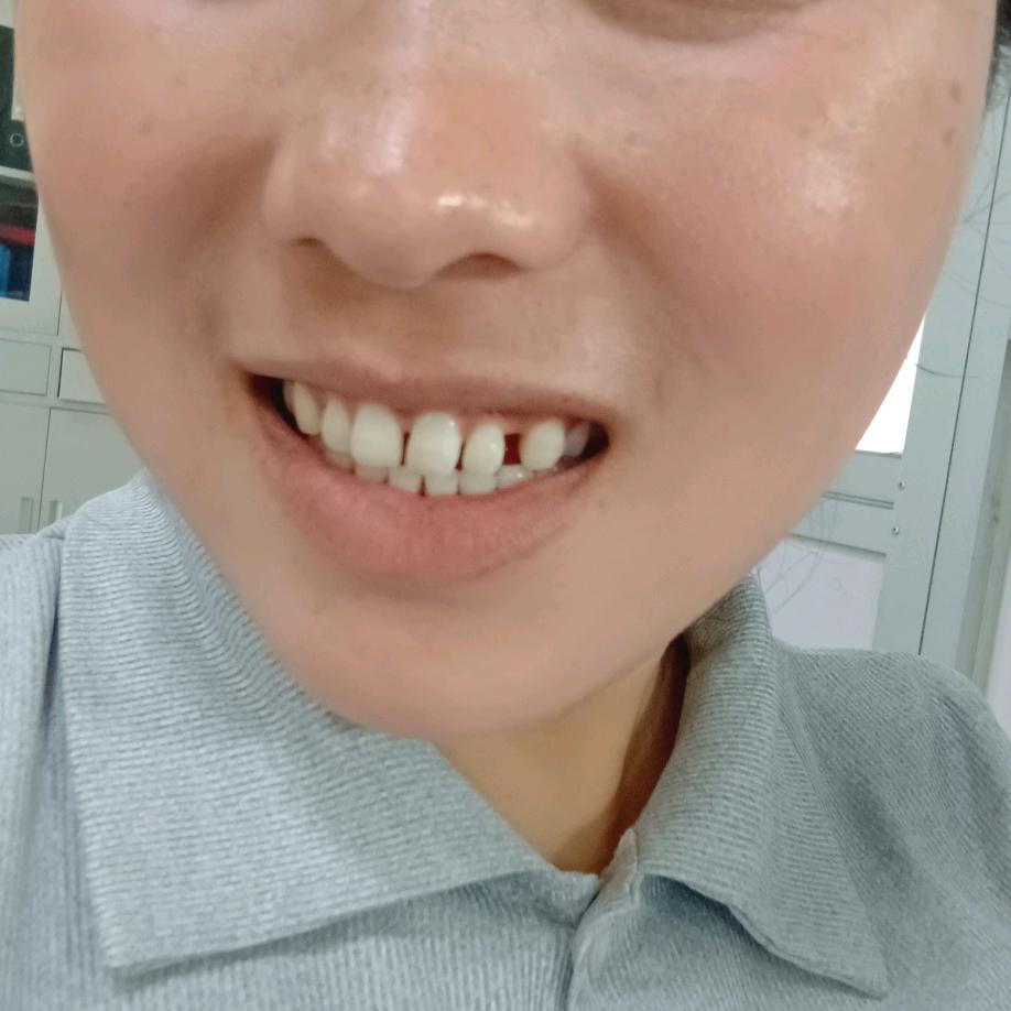 双双
