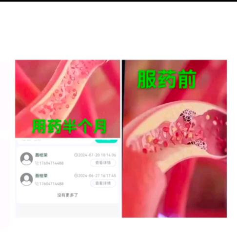 孤树不成林🌲🌲🌲