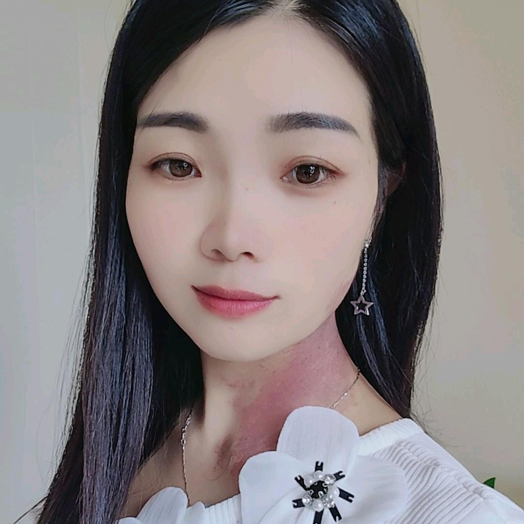 钱宝儿👉胎记女孩
