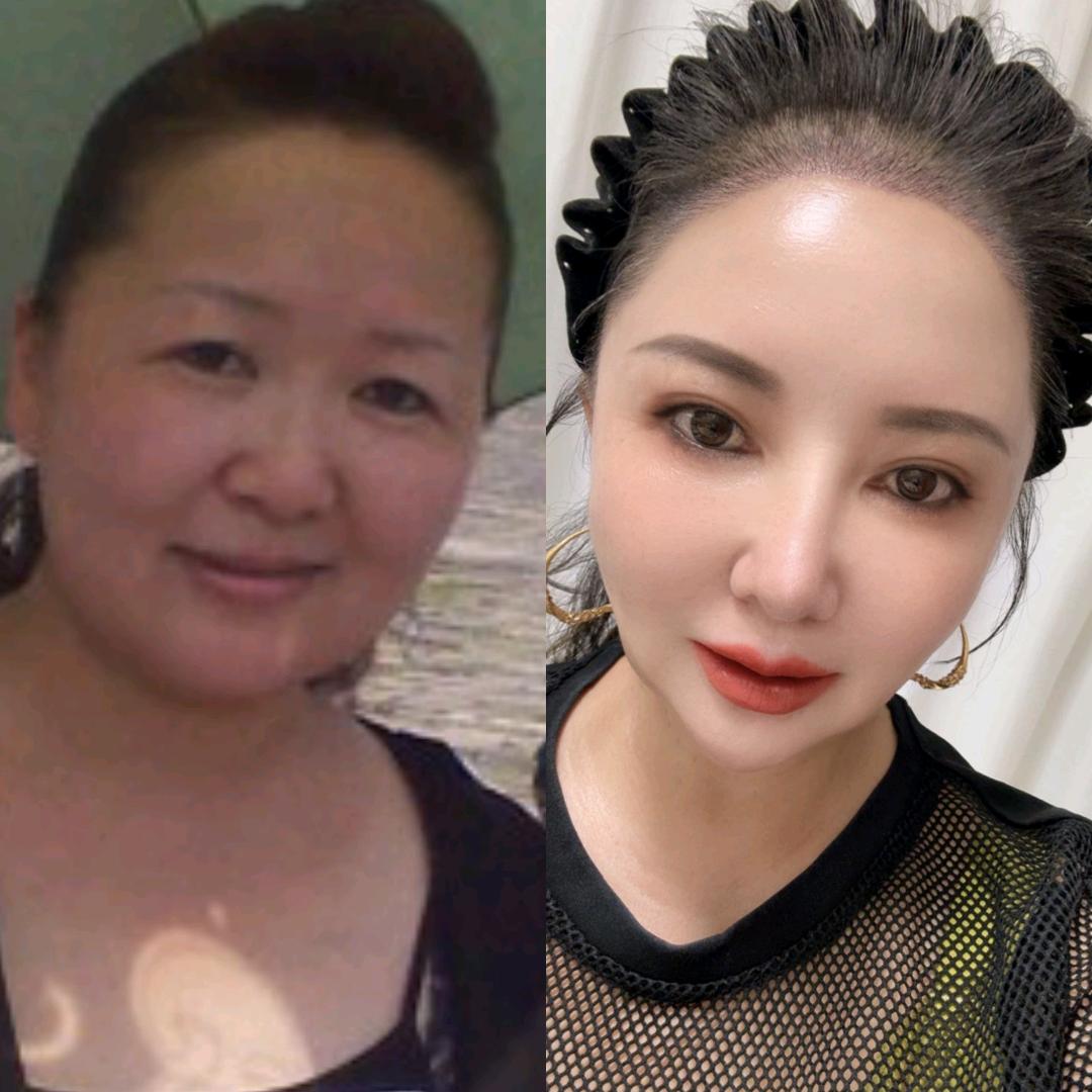 安缇聊抗衰4
