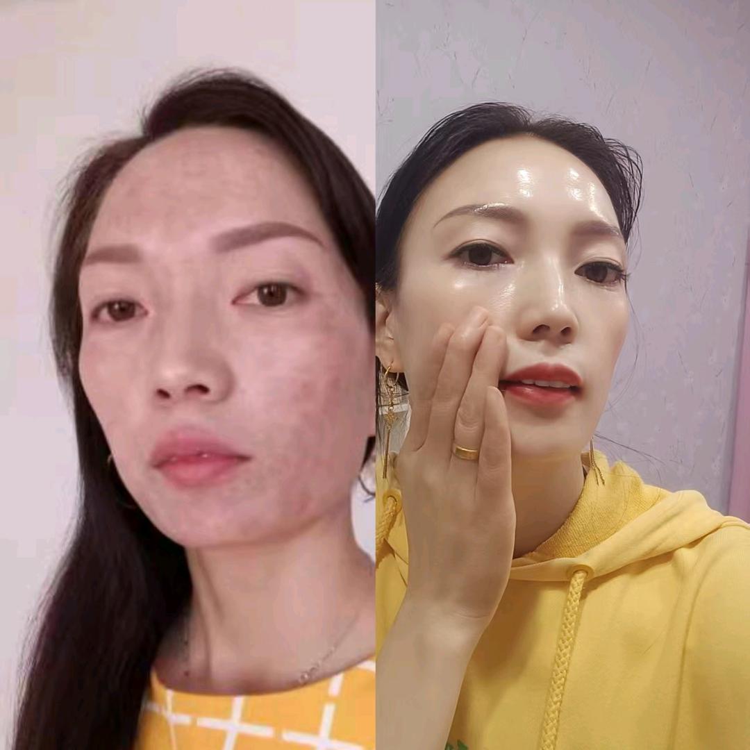 洪雅,阿秀,美容
