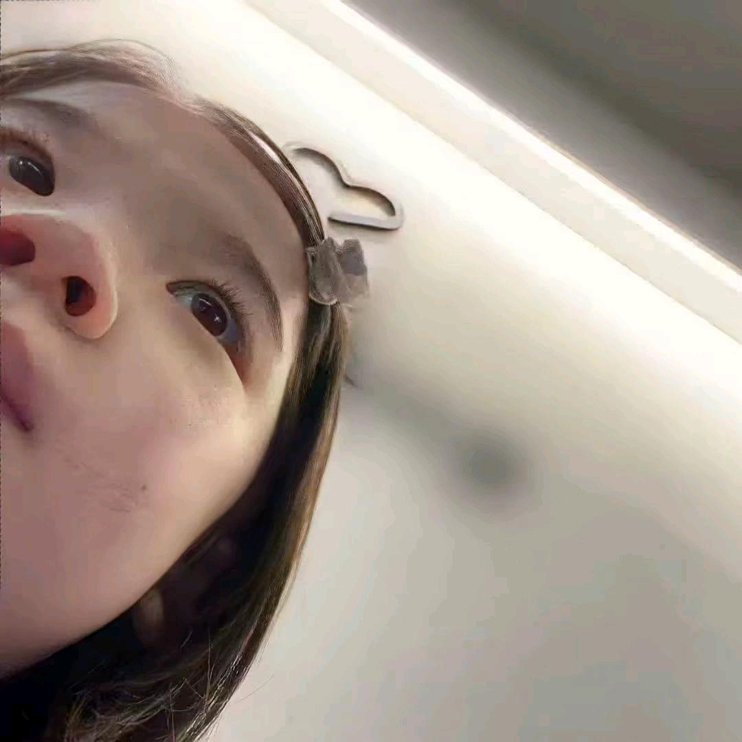 伊佳