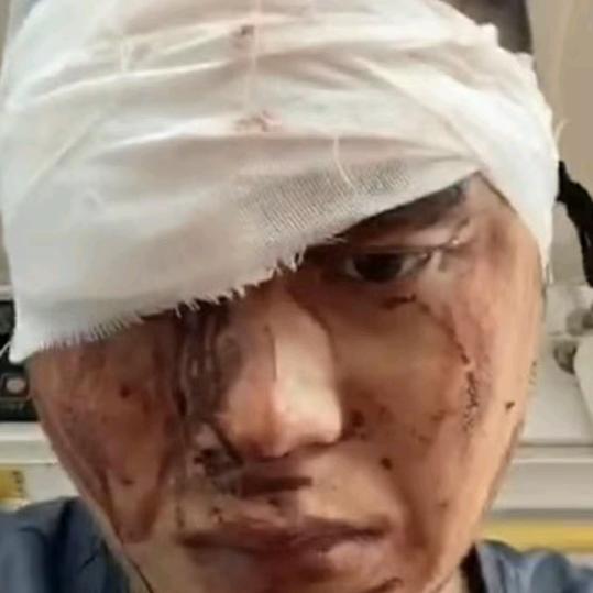 我的身份证名字叫高飞我是个母猪疯病犯病者