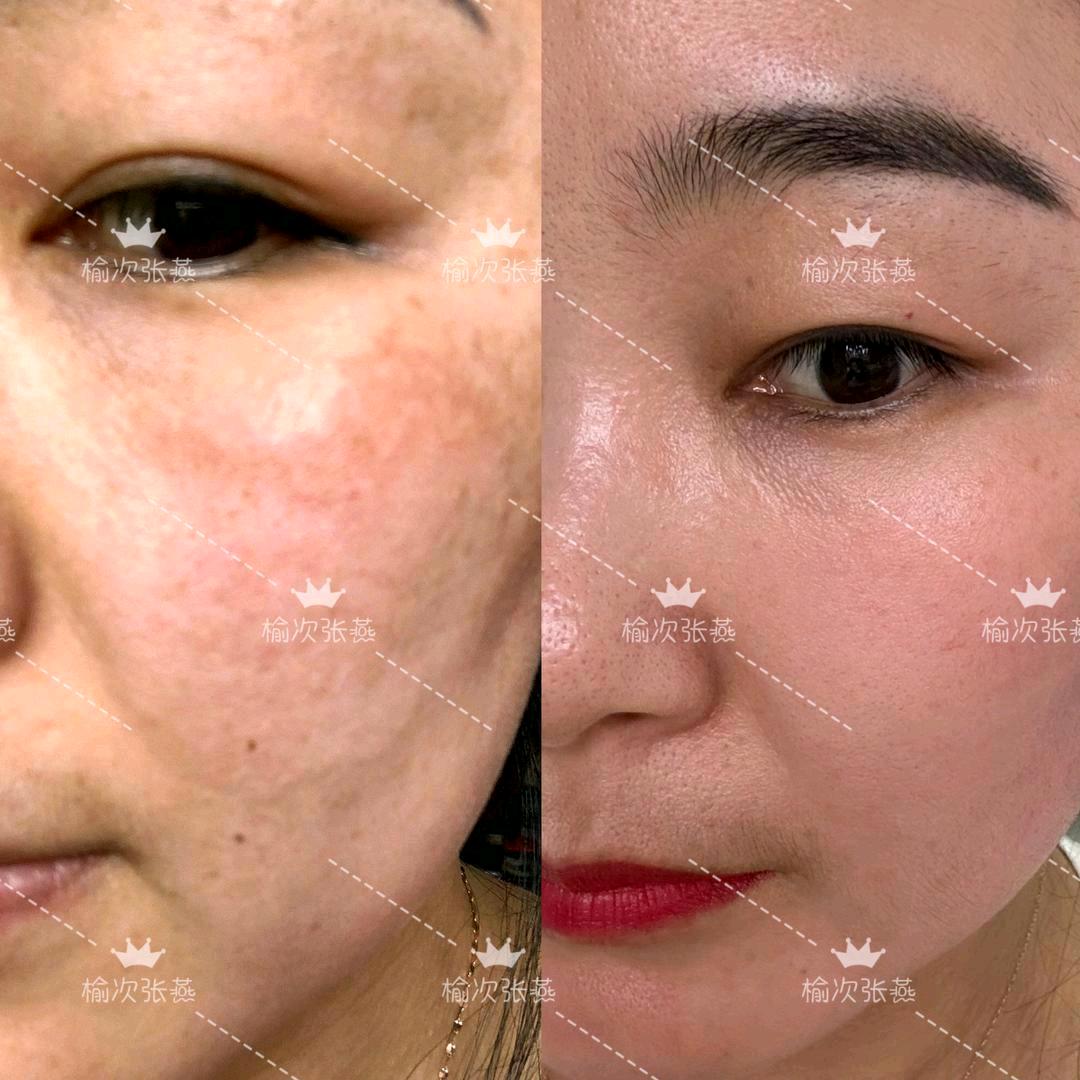 榆次张燕下班快乐8