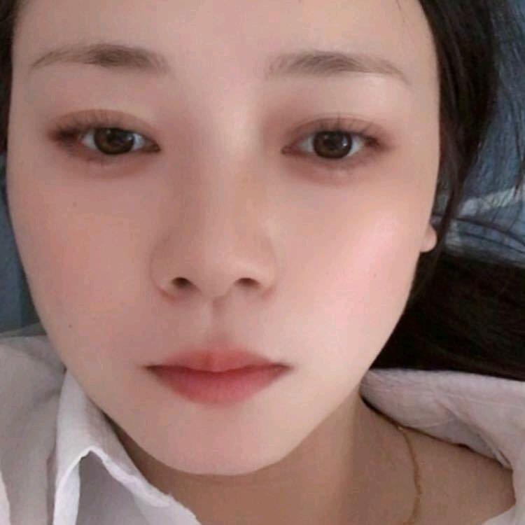 森林迷了鹿