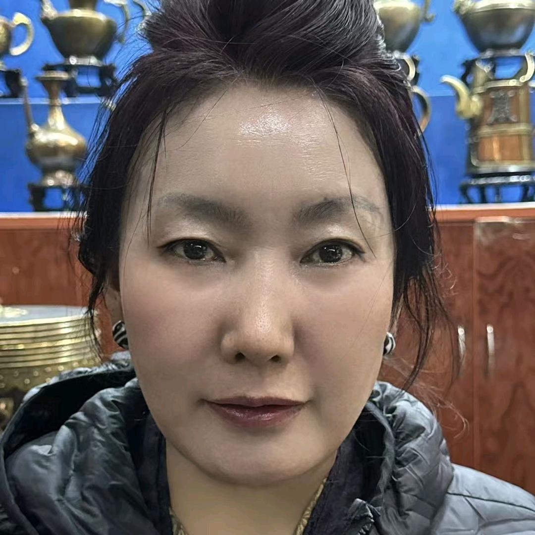 雪山阿佳