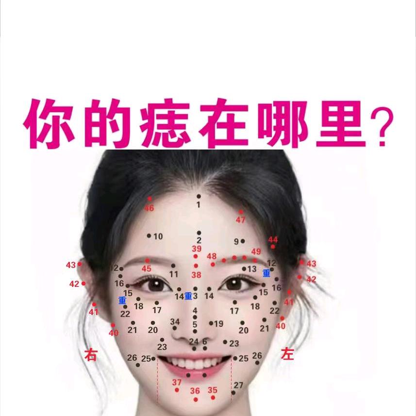 痣顾问