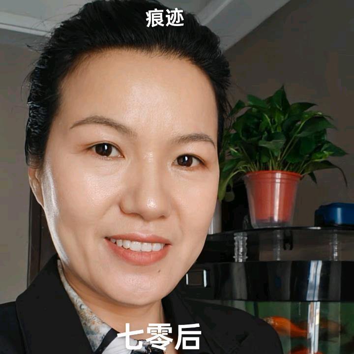 女王