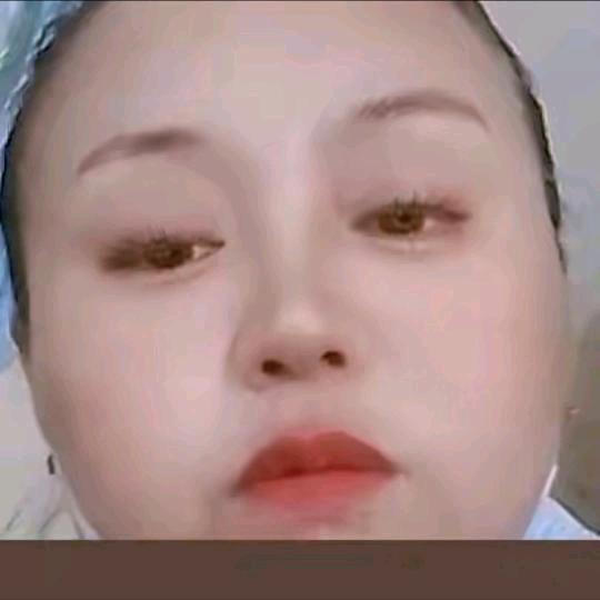 雪