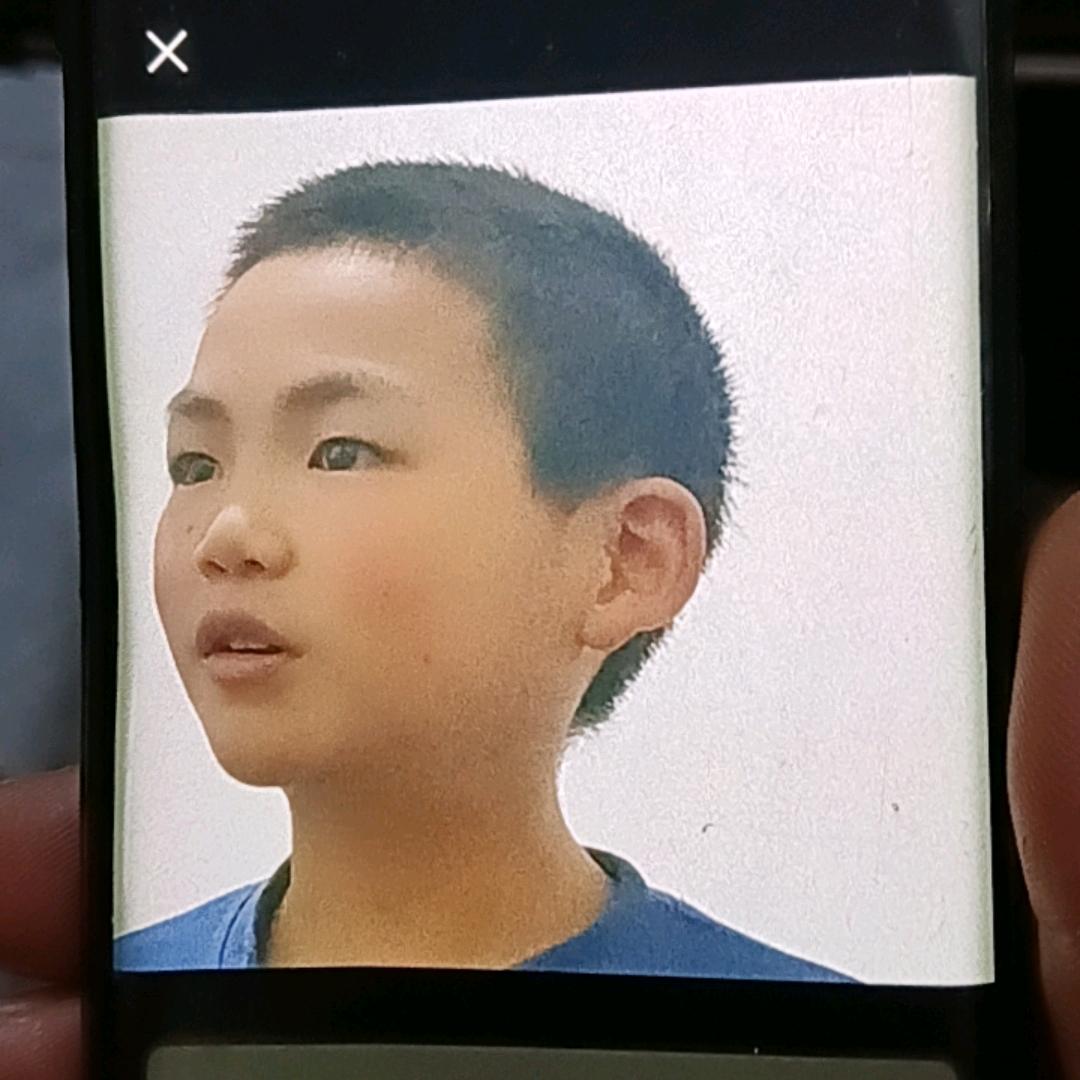 中国:云南
