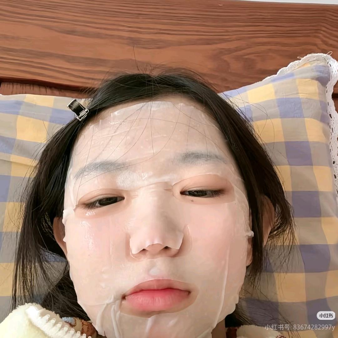 幼痣