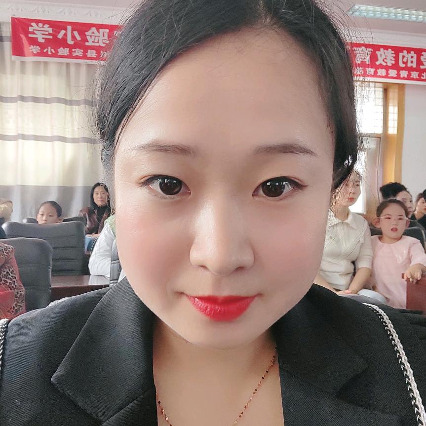 盼盼髋关节置换（没截骨已上岸）