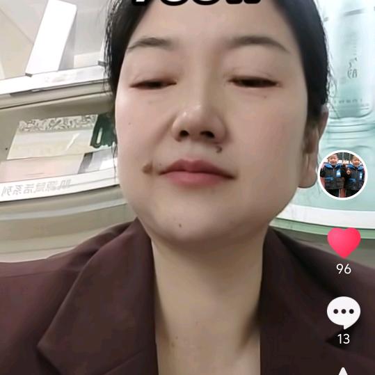 双胞胎