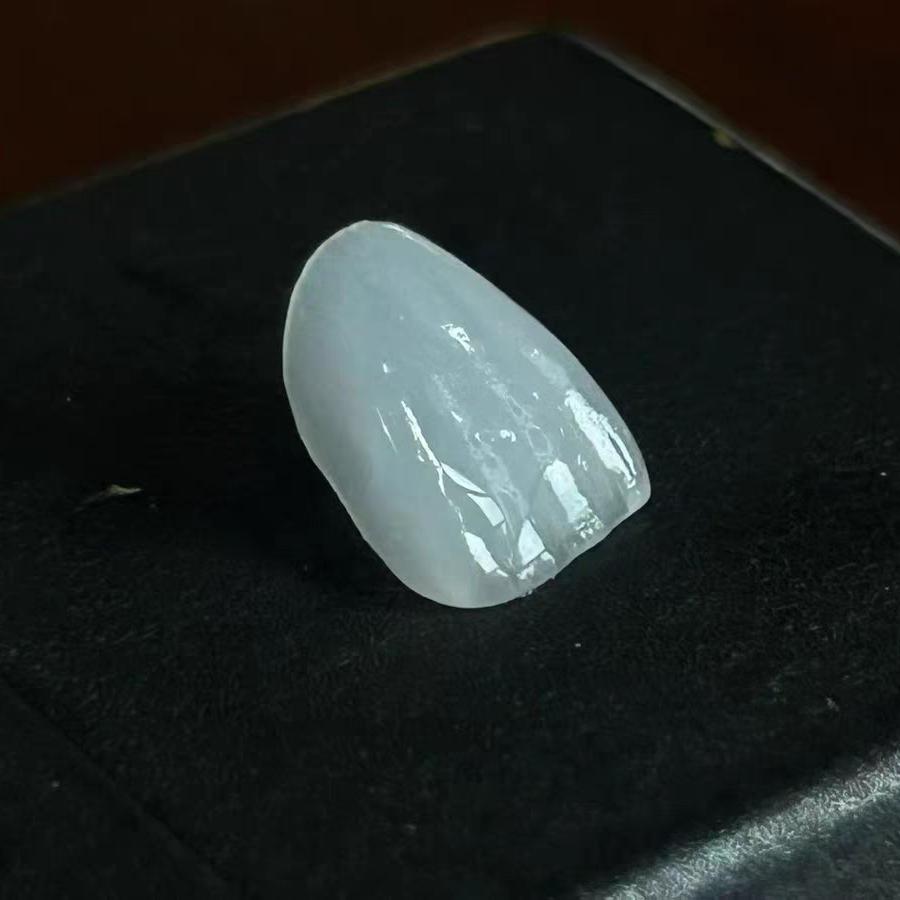 全瓷牙贴面源头工厂